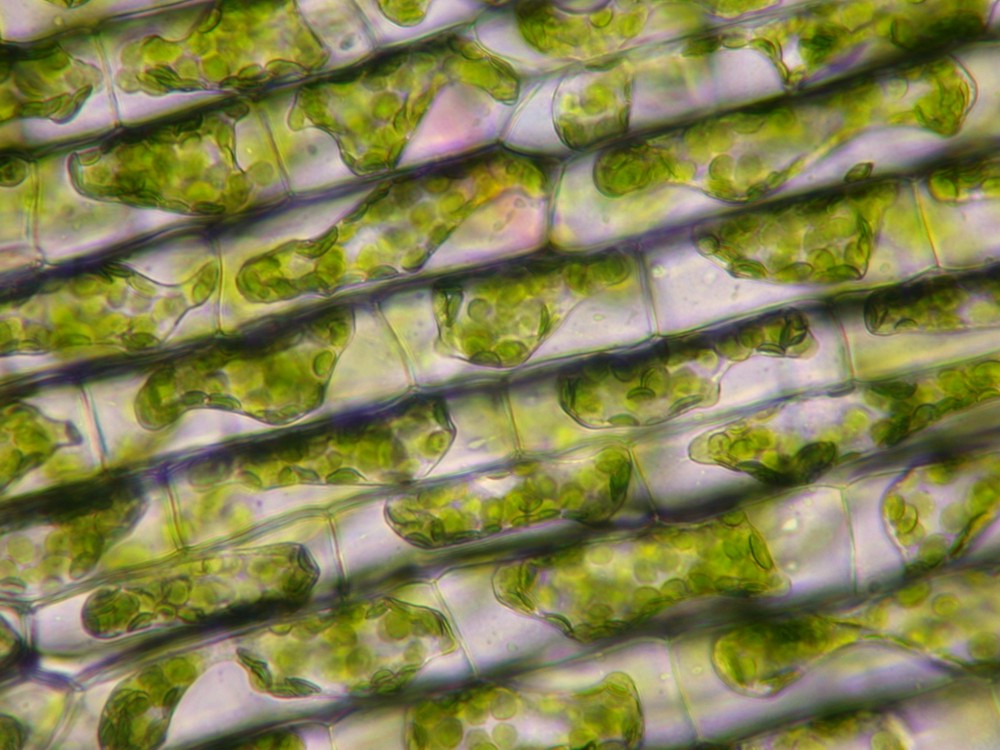 Featured image of post Plant Cell Chloroplast Microscope : In most plant cells, the organelles that are visible under a compound {light} microscope are the cell wall, cell membrane, cytoplasm, central vacuole, and nucleus.